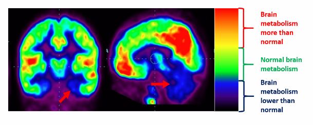 Diagnosing Team For Autism